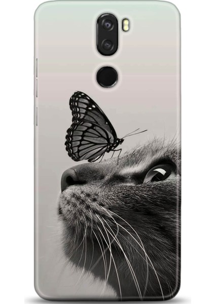 Vestel Venüs Z30 Kılıf Hd Baskılı Kılıf - Followed Institution 0564