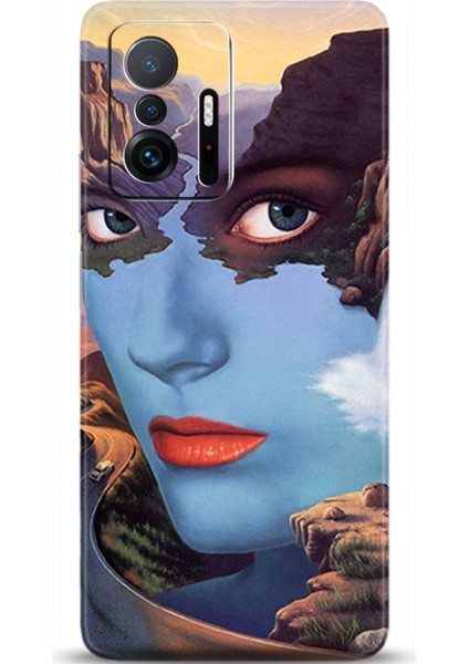 Xiaomi Mi 11T Kılıf Hd Baskılı Kılıf - Followed Institution 0242