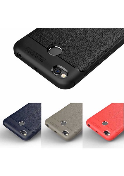 Xiaomi Redmi 4x Deri Görünümlü Lux Niss Silikon Kılıf modelleri
