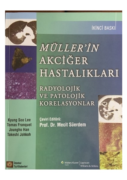 Müller’in Akciğer Hastalıkları - Mecit Süerdem