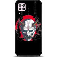 Noprin Huawei P40 Lite Kılıf Hd Baskılı Kılıf - Followed Institution 0229