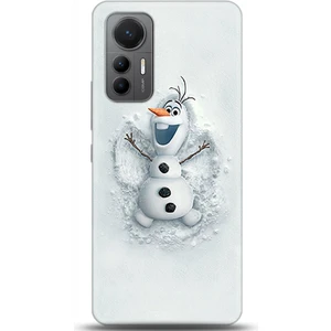 Phone Kılıf Xiaomi Mi 12 Lite Kılıf Hd Baskılı Kılıf - Followed Institution 0368