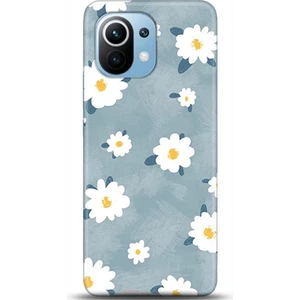 Phone Kılıf Xiaomi Mi 11 Kılıf Hd Baskılı Kılıf - Followed Institution 0134
