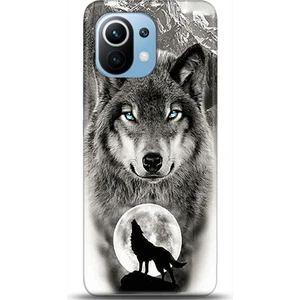 Phone Kılıf Xiaomi Mi 11 Kılıf Hd Baskılı Kılıf - Followed Institution 0049