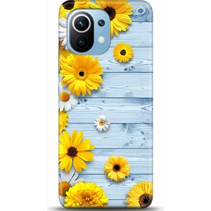Phone Kılıf Xiaomi Mi 11 Kılıf Hd Baskılı Kılıf - Followed Institution 0482