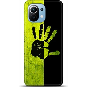 Phone Kılıf Xiaomi Mi 11 Kılıf Hd Baskılı Kılıf - Followed Institution 0648