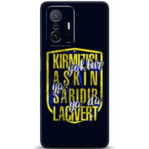 Phone Kılıf Xiaomi Mi 11T Kılıf Hd Baskılı Kılıf - Followed Institution 0551
