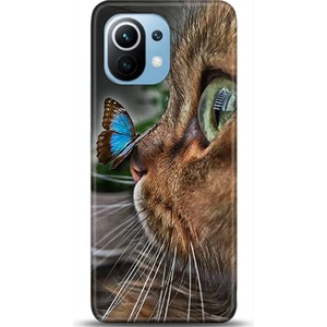 Phone Kılıf Xiaomi Mi 11 Kılıf Hd Baskılı Kılıf - Followed Institution 0031