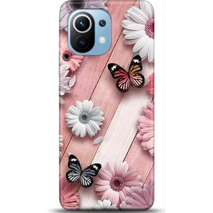 Phone Kılıf Xiaomi Mi 11 Kılıf Hd Baskılı Kılıf - Followed Institution 0641