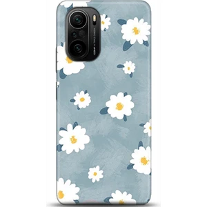 Phone Kılıf Xiaomi Mi 11i Kılıf Hd Baskılı Kılıf - Followed Institution 0134
