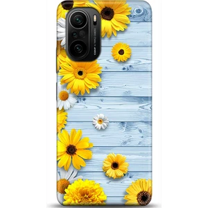 Phone Kılıf Xiaomi Mi 11i Kılıf Hd Baskılı Kılıf - Followed Institution 0482