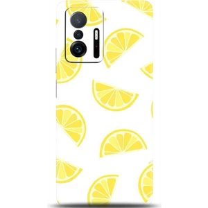 Phone Kılıf Xiaomi Mi 11T Pro Kılıf Hd Baskılı Kılıf - Followed Institution 0105