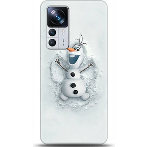 Phone Kılıf Xiaomi Mi 12T Kılıf Hd Baskılı Kılıf - Followed Institution 0368