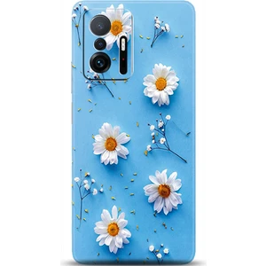 Phone Kılıf Xiaomi Mi 11T Pro Kılıf Hd Baskılı Kılıf - Followed Institution 0170