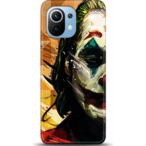Phone Kılıf Xiaomi Mi 11 Kılıf Hd Baskılı Kılıf - Followed Institution 0442