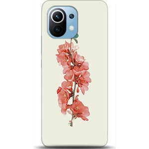 Phone Kılıf Xiaomi Mi 11 Kılıf Hd Baskılı Kılıf - Followed Institution 0346