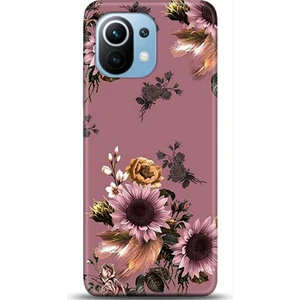 Phone Kılıf Xiaomi Mi 11 Kılıf Hd Baskılı Kılıf - Followed Institution 0488
