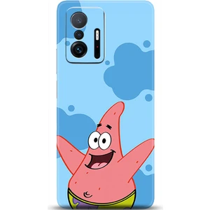 Phone Kılıf Xiaomi Mi 11T Kılıf Hd Baskılı Kılıf - Followed Institution 0676