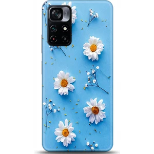 Phone Kılıf Xiaomi Poco M4 Pro 5g  Kılıf Hd Baskılı Kılıf - Followed Institution 0170