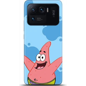 Phone Kılıf Xiaomi Mi 11 Ultra Kılıf Hd Baskılı Kılıf - Followed Institution 0676