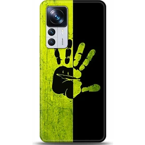 Phone Kılıf Xiaomi Mi 12T Kılıf Hd Baskılı Kılıf - Followed Institution 0648