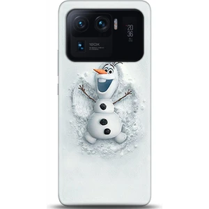 Phone Kılıf Xiaomi Mi 11 Ultra Kılıf Hd Baskılı Kılıf - Followed Institution 0368
