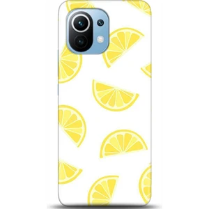 Phone Kılıf Xiaomi Mi 11 Kılıf Hd Baskılı Kılıf - Followed Institution 0105