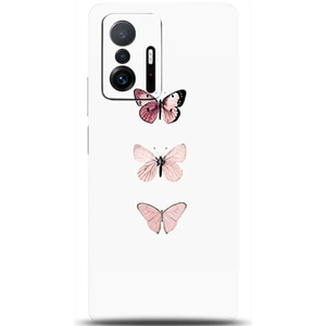 Phone Kılıf Xiaomi Mi 11T Pro Kılıf Hd Baskılı Kılıf - Followed Institution 0334