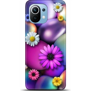 Phone Kılıf Xiaomi Mi 11 Kılıf Hd Baskılı Kılıf - Followed Institution 0480
