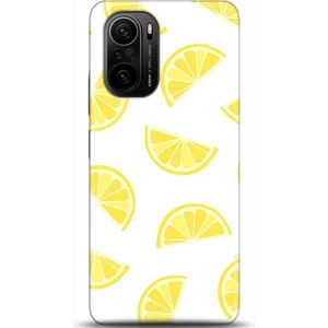 Phone Kılıf Xiaomi Mi 11i Kılıf Hd Baskılı Kılıf - Followed Institution 0105