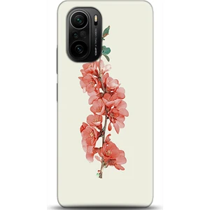 Phone Kılıf Xiaomi Mi 11i Kılıf Hd Baskılı Kılıf - Followed Institution 0346