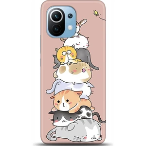 Phone Kılıf Xiaomi Mi 11 Kılıf Hd Baskılı Kılıf - Followed Institution 0058