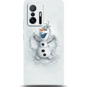Phone Kılıf Xiaomi Mi 11T Pro Kılıf Hd Baskılı Kılıf - Followed Institution 0368