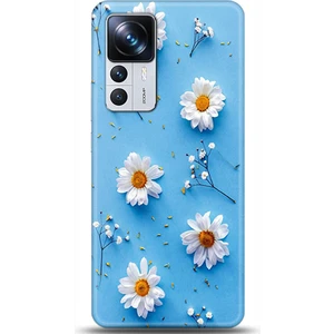 Phone Kılıf Xiaomi Mi 12T Kılıf Hd Baskılı Kılıf - Followed Institution 0170
