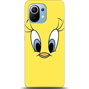 Phone Kılıf Xiaomi Mi 11 Kılıf Hd Baskılı Kılıf - Followed Institution 0080