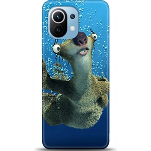 Phone Kılıf Xiaomi Mi 11 Kılıf Hd Baskılı Kılıf - Followed Institution 0124