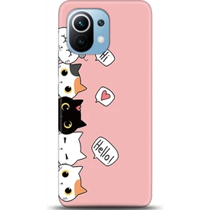 Phone Kılıf Xiaomi Mi 11 Kılıf Hd Baskılı Kılıf - Followed Institution 0061