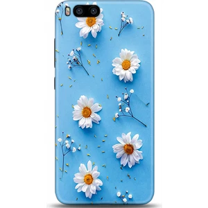 Phone Kılıf Xiaomi Mi 6 Kılıf Hd Baskılı Kılıf - Followed Institution 0170