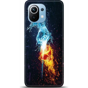 Phone Kılıf Xiaomi Mi 11 Kılıf Hd Baskılı Kılıf - Followed Institution 0366