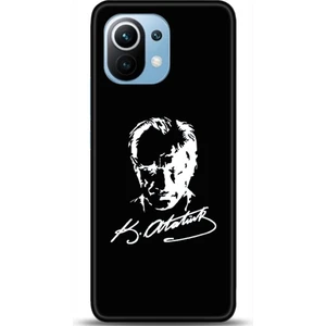 Phone Kılıf Xiaomi Mi 11 Kılıf Hd Baskılı Kılıf - Followed Institution 0550