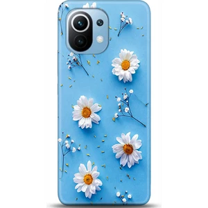 Phone Kılıf Xiaomi Mi 11 Kılıf Hd Baskılı Kılıf - Followed Institution 0170