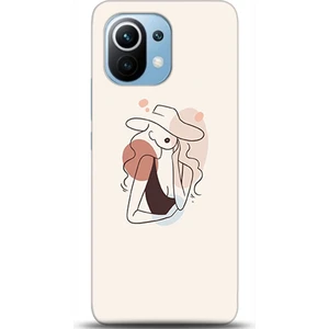 Phone Kılıf Xiaomi Mi 11 Kılıf Hd Baskılı Kılıf - Followed Institution 0380