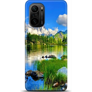 Phone Kılıf Xiaomi Mi 11i Kılıf Hd Baskılı Kılıf - Followed Institution 0133