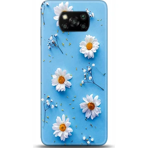 Phone Kılıf Xiaomi Poco X3 Pro Kılıf Hd Baskılı Kılıf - Followed Institution 0170