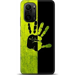 Phone Kılıf Xiaomi Mi 11i Kılıf Hd Baskılı Kılıf - Followed Institution 0648