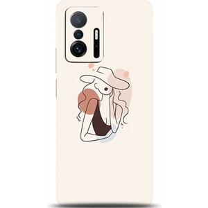 Phone Kılıf Xiaomi Mi 11T Pro Kılıf Hd Baskılı Kılıf - Followed Institution 0380