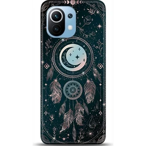 Phone Kılıf Xiaomi Mi 11 Kılıf Hd Baskılı Kılıf - Followed Institution 0197