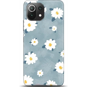 Phone Kılıf Xiaomi Mi 11 Lite Kılıf Hd Baskılı Kılıf - Followed Institution 0134
