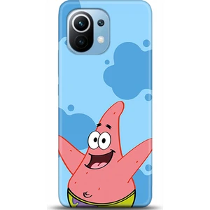 Phone Kılıf Xiaomi Mi 11 Kılıf Hd Baskılı Kılıf - Followed Institution 0676