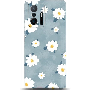 Phone Kılıf Xiaomi Mi 11T Kılıf Hd Baskılı Kılıf - Followed Institution 0134